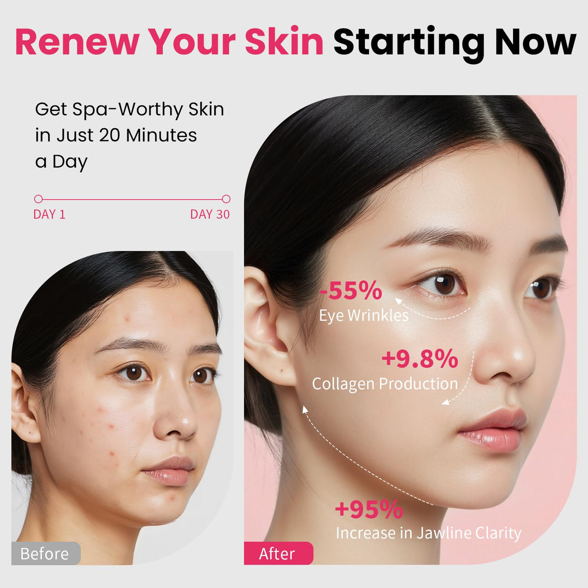 Face Lift Device – 8 in 1 Skin Tightening and Lifting, LED Light Therapy for Wrinkles, Korean Skin Care, Spa-Grade Facial Massager Lifting & Firming Beauty Massager (White)